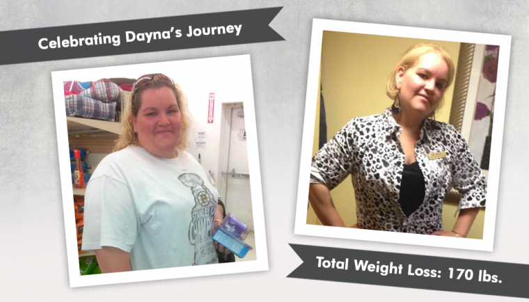 Before and After VSG with dayna82