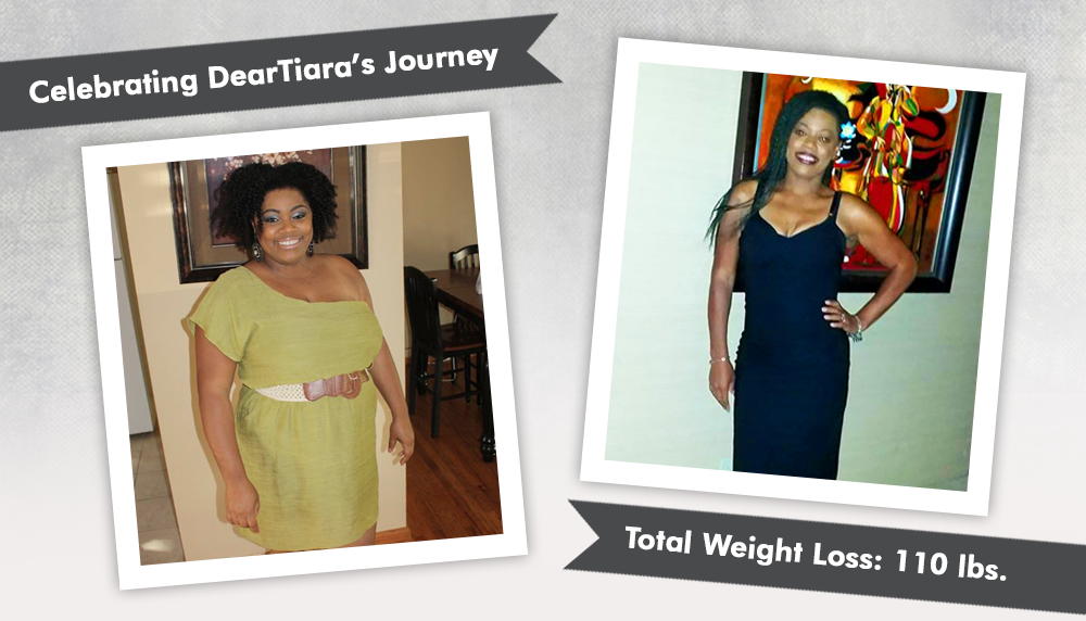 Before & After Gastric Bypass RNY with Deartiara, losing 110 lbs