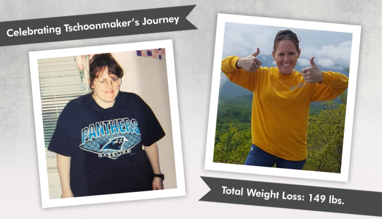 Before After RNY in 2001 with Tschoonmaker losing 149 pounds
